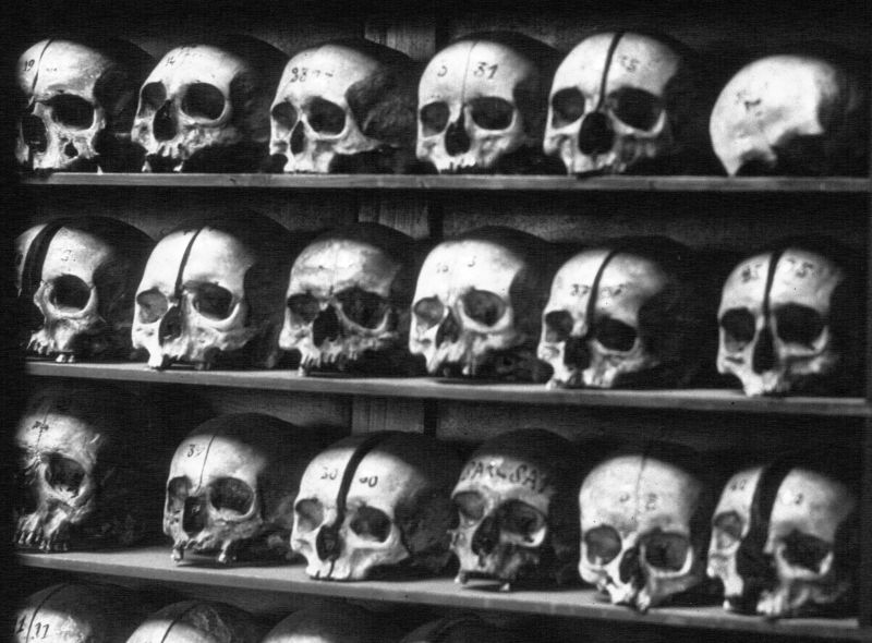 Collection de crânes du musée Dupuytren
